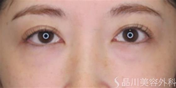 症例NO.47734のBEFORE写真