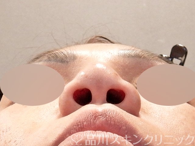 症例NO.67918のBEFORE写真