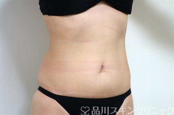 症例NO.29422のBEFORE写真