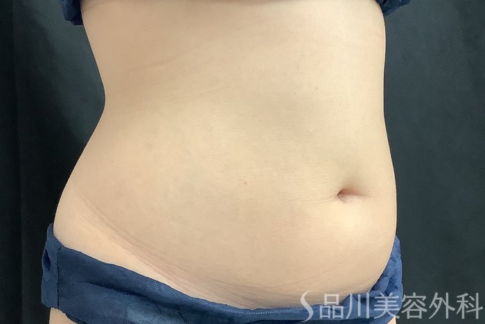 症例NO.68158のBEFORE写真
