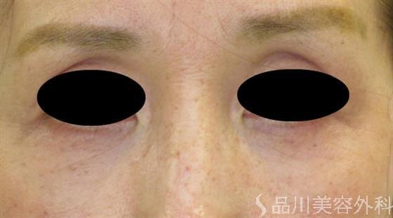 症例NO.47823のAFTER写真
