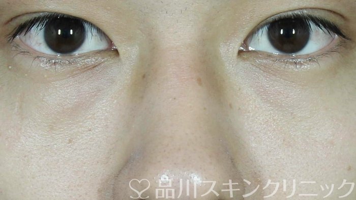 症例NO.72073のBEFORE写真