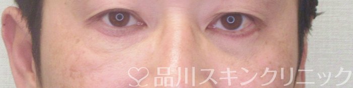 症例NO.73726のAFTER写真