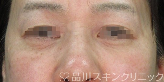 症例NO.74219のAFTER写真