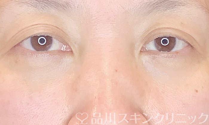 症例NO.69813のAFTER写真