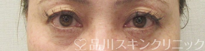 症例NO.70129のBEFORE写真