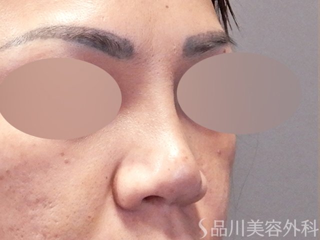 症例NO.67918のBEFORE写真