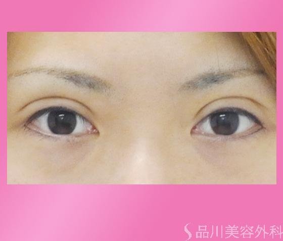 症例NO.673のAFTER写真