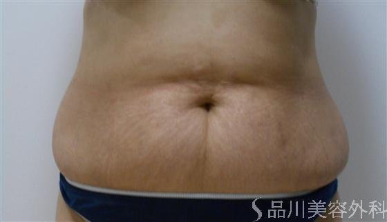 症例NO.19819のAFTER写真