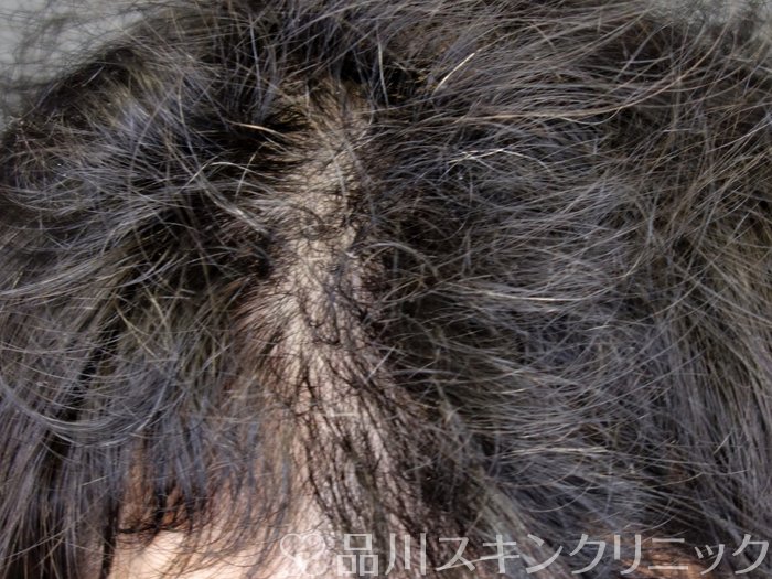 症例NO.73493のBEFORE写真