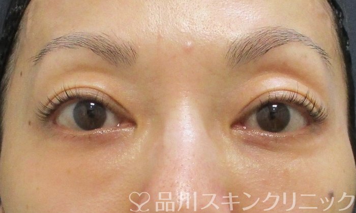 症例NO.70407のAFTER写真