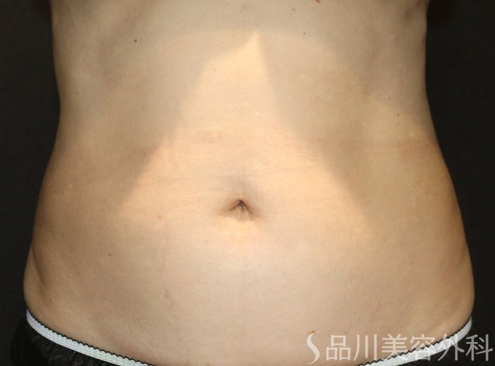 症例NO.73257のBEFORE写真