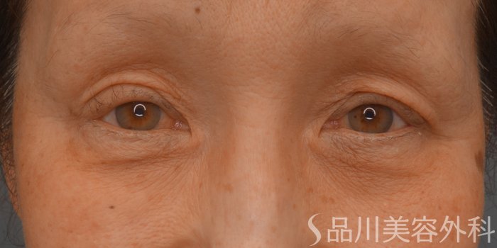 症例NO.73421のBEFORE写真