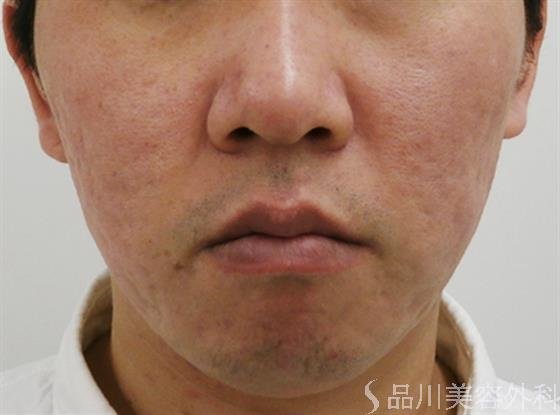 症例NO.30673のAFTER写真