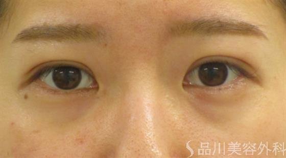 症例NO.47260のAFTER写真