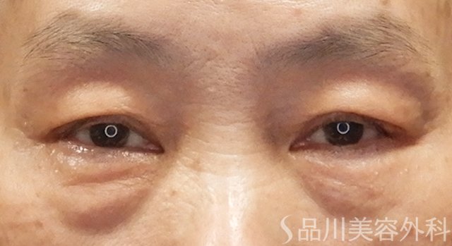 症例NO.73848のBEFORE写真