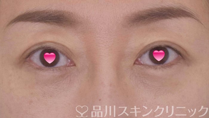 症例NO.65138のAFTER写真