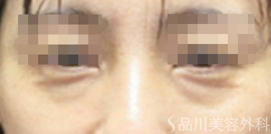 症例NO.73253のBEFORE写真