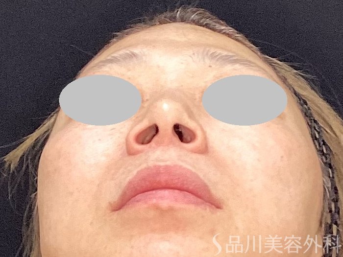 症例NO.73183のBEFORE写真