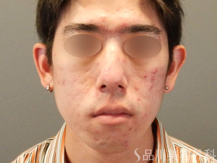 症例NO.67922のBEFORE写真