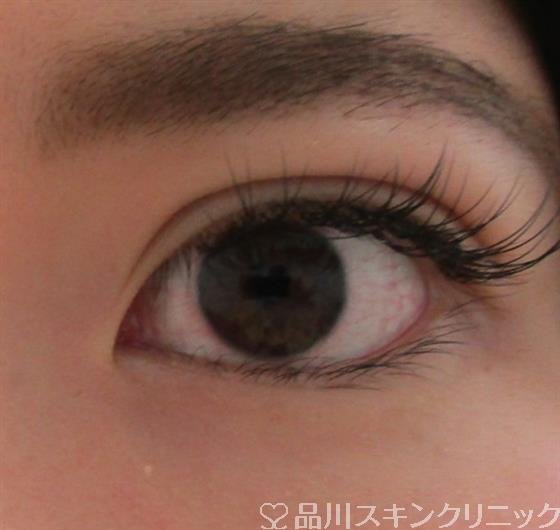 症例NO.30996のAFTER写真