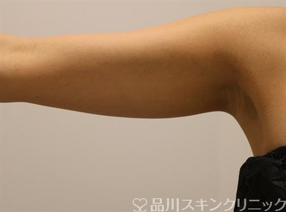 症例NO.42193のBEFORE写真