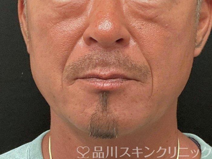 症例NO.73959のBEFORE写真