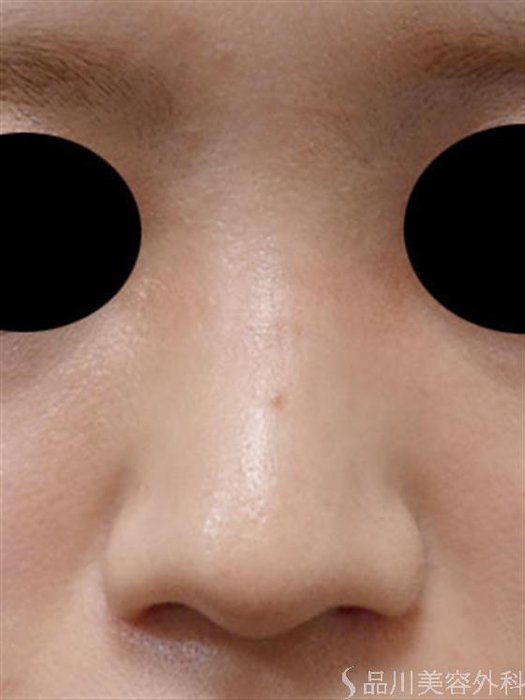 症例NO.54273のAFTER写真