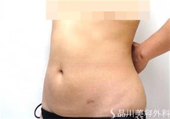 症例NO.21738のAFTER写真