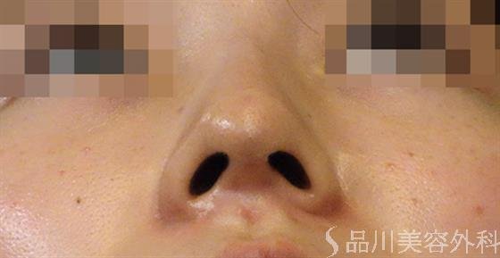 症例NO.36286のAFTER写真