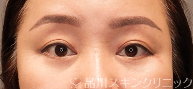 症例NO.71137のAFTER写真