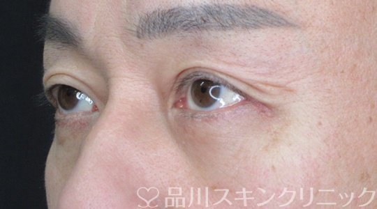 症例NO.69202のAFTER写真