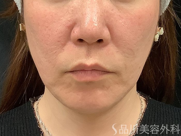 症例NO.67791のBEFORE写真