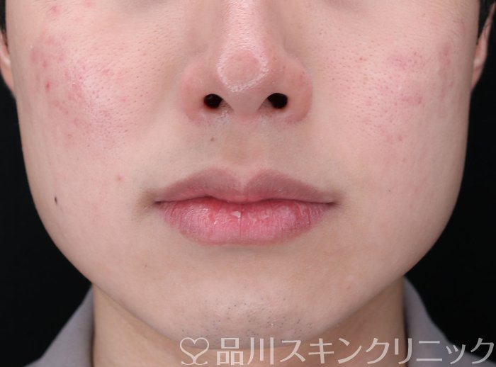 症例NO.73719のAFTER写真