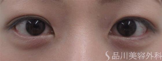 症例NO.20791のBEFORE写真