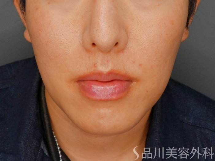 症例NO.73127のBEFORE写真