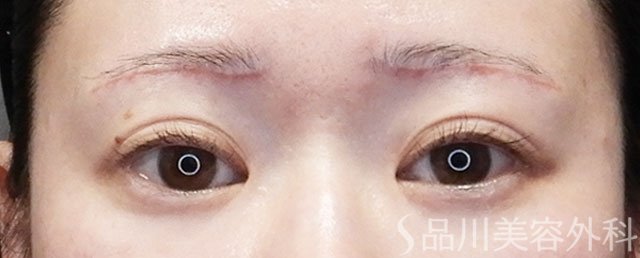 症例NO.73107のAFTER写真