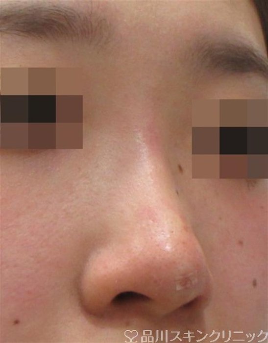 症例NO.27138のAFTER写真