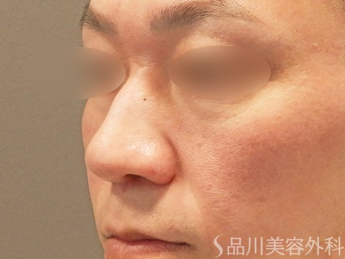 症例NO.70638のBEFORE写真