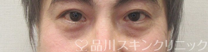 症例NO.70224のBEFORE写真