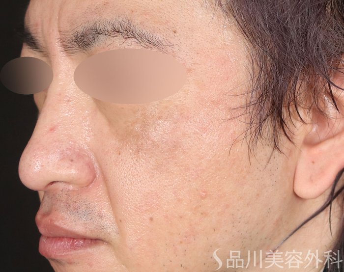 症例NO.72473のAFTER写真