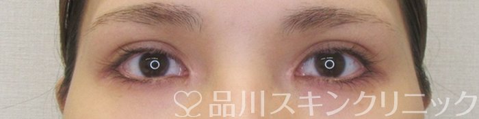 症例NO.70226のAFTER写真