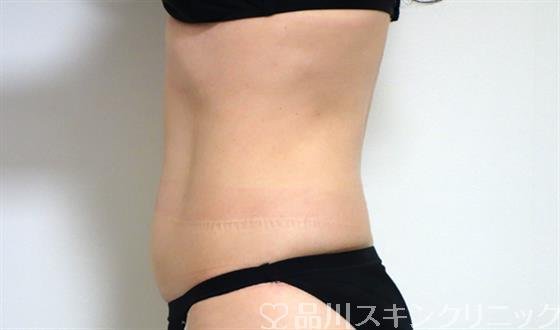 症例NO.29422のBEFORE写真