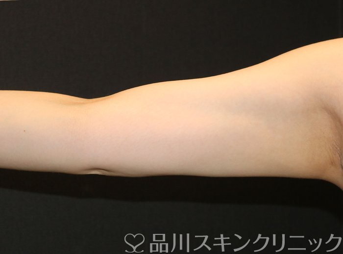 症例NO.70109のAFTER写真