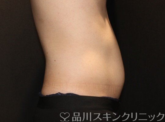 症例NO.72098のBEFORE写真