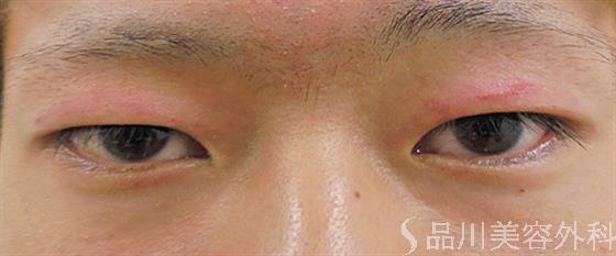 症例NO.25031のBEFORE写真