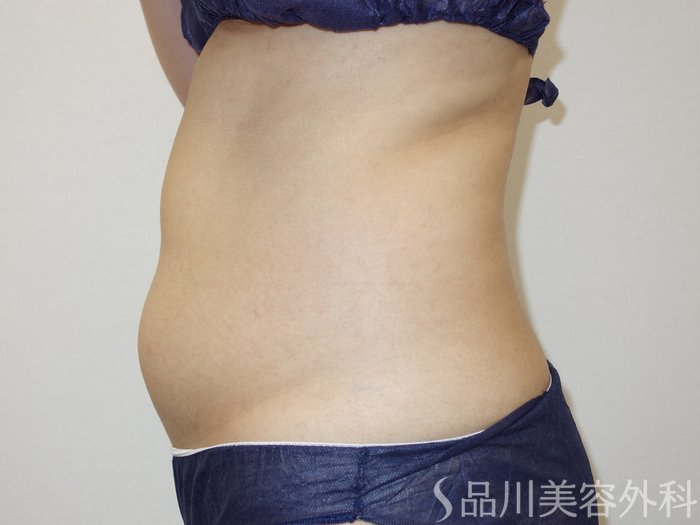 症例NO.73687のBEFORE写真