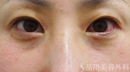 症例NO.72627のAFTER写真