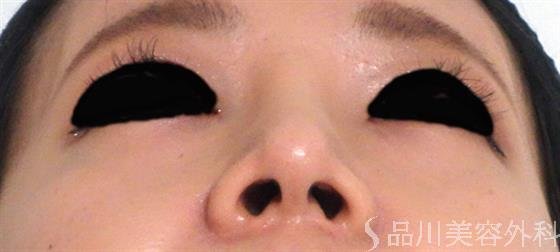 症例NO.31659のAFTER写真