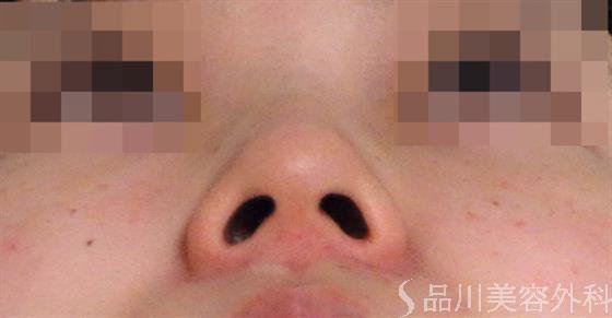 症例NO.36286のBEFORE写真